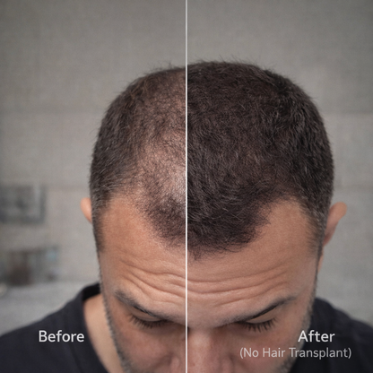 OLYRA™ Hair Density Concealer