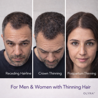 OLYRA™ Hair Density Concealer